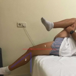 Psoas corto ¿cómo lo sé?