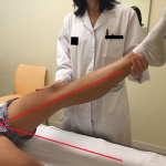 Medir acortamiento de isquiotibiales