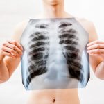 La respiración y la lesión medular